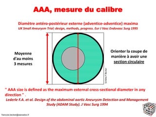 AAA, mesure du calibre
Diamètre antéro-postérieur externe (adventice-adventice) maxima
UK Small Aneurysm Trial: design, methods, progress. Eur J Vasc Endovasc Surg 1995
Orienter la coupe de
manière à avoir une
section circulaire
" AAA size is defined as the maximum external cross-sectional diameter in any
direction " .
Lederle F.A. et al. Design of the abdominal aortic Aneurysm Detection and Management
Study (ADAM Study). J Vasc Surg 1994
Moyenne
d'au moins
3 mesures
SchémaF.Becker
francois.becker@wanadoo.fr
 