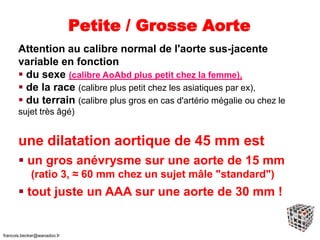 Petite / Grosse Aorte
Attention au calibre normal de l'aorte sus-jacente
variable en fonction
 du sexe (calibre AoAbd plus petit chez la femme),
 de la race (calibre plus petit chez les asiatiques par ex),
 du terrain (calibre plus gros en cas d'artério mégalie ou chez le
sujet très âgé)
une dilatation aortique de 45 mm est
 un gros anévrysme sur une aorte de 15 mm
(ratio 3, ≈ 60 mm chez un sujet mâle "standard")
 tout juste un AAA sur une aorte de 30 mm !
francois.becker@wanadoo.fr
 