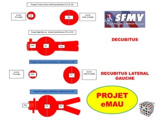 DECUBITUS
DECUBITUS LATERAL
GAUCHE
PROJET
eMAU
 