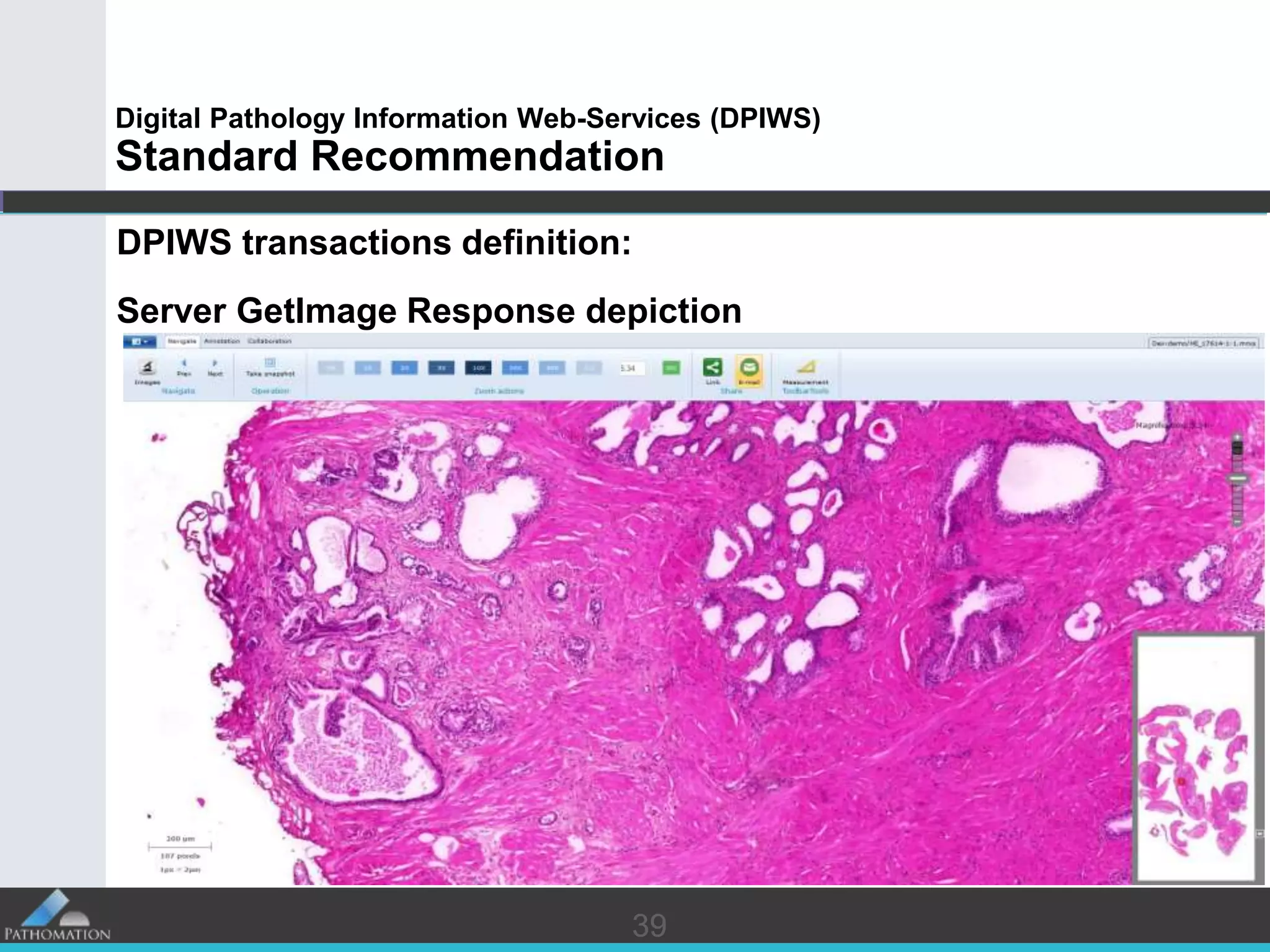 3939
Digital Pathology Information Web-Services (DPIWS)
Standard Recommendation
DPIWS transactions definition:
Server GetImage Response depiction
 