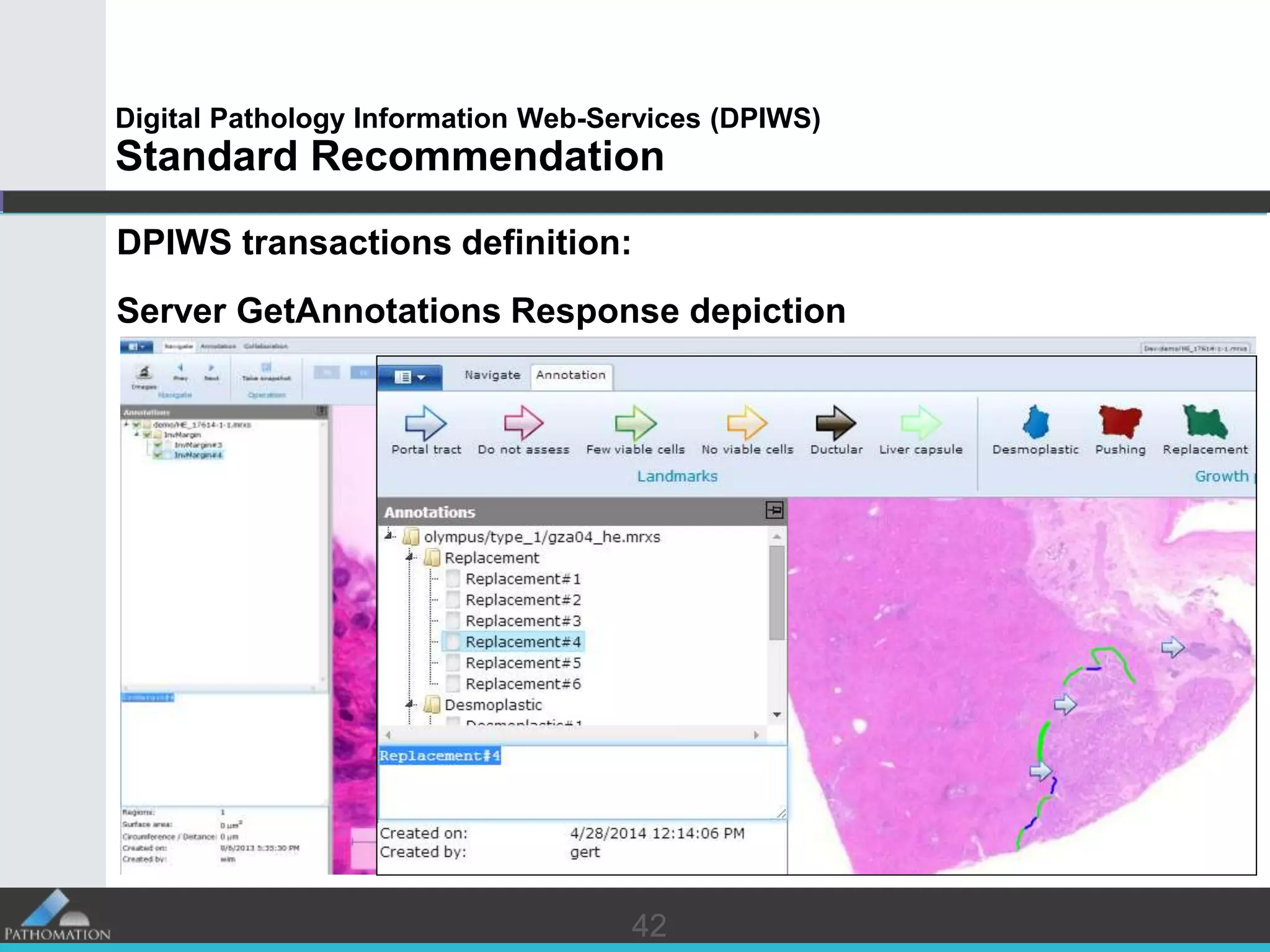4242
Digital Pathology Information Web-Services (DPIWS)
Standard Recommendation
DPIWS transactions definition:
Server GetAnnotations Response depiction
 