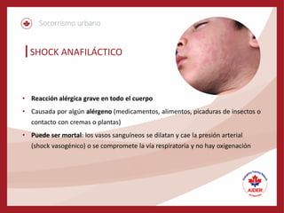 SHOCK ANAFILÁCTICO
• Reacción alérgica grave en todo el cuerpo
• Causada por algún alérgeno (medicamentos, alimentos, picaduras de insectos o
contacto con cremas o plantas)
• Puede ser mortal: los vasos sanguíneos se dilatan y cae la presión arterial
(shock vasogénico) o se compromete la vía respiratoria y no hay oxigenación
 