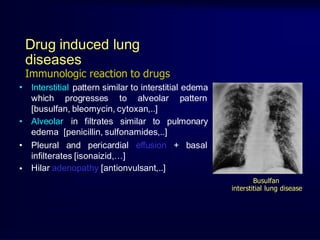 approach to interstitial lung disease | PPTX