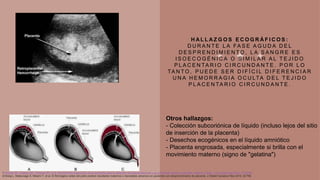 H A L L A Z G O S E C O G R Á F I C O S :
D U R A N T E L A FA S E A G U D A D E L
D E S P R E N D I M I E N T O , L A S A N G R E E S
I S O E C O G É N I C A O S I M I L A R A L T E J I D O
P L A C E N TA R I O C I R C U N D A N T E . P O R L O
TA N T O , P U E D E S E R D I F Í C I L D I F E R E N C I A R
U N A H E M O R R A G I A O C U LTA D E L T E J I D O
P L A C E N TA R I O C I R C U N D A N T E .
1.Shinde GR, Vaswani BP, Patange RP, et al. Rendimiento diagnóstico de la ecografía para la detección de desprendimiento y su correlación clínica y resultado materno y fetal. J Clin Diagn Res 2016; 10:QC04.
2.Wang L, Matsunaga S, Mikami Y, et al. El fibrinógeno antes del parto predice resultados maternos o neonatales adversos en pacientes con desprendimiento de placenta. J Obstet Gynaecol Res 2016; 42:796.
Otros hallazgos:
- Colección subcoriónica de líquido (incluso lejos del sitio
de inserción de la placenta)
- Desechos ecogénicos en el líquido amniótico
- Placenta engrosada, especialmente si brilla con el
movimiento materno (signo de "gelatina")
 