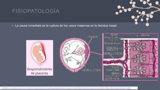 FISIOPATOLOGÍA
• La causa inmediata es la ruptura de los vasos maternos en la decidua basal.
1.Mehraban SS, Lagodka S, Kydd J, et al. Factores de riesgo predictivos de resultados perinatales adversos después de un traumatismo abdominal cerrado en el embarazo. J Matern Fetal Neonatal Med 2022; 35:8929.
 