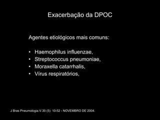Exacerbação da DPOC Agentes etiológicos mais comuns: Haemophilus influenzae, Streptococcus pneumoniae, Moraxella catarrhalis,  Vírus respiratórios, J Bras Pneumologia.V.30 (5): 10-52 - NOVEMBRO DE 2004. 