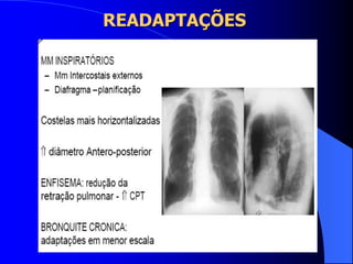 READAPTAÇÕES
 
