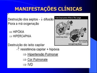 MANIFESTAÇÕES CLÍNICAS
 