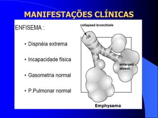 MANIFESTAÇÕES CLÍNICAS
 