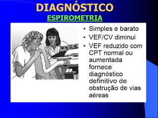 DIAGNÓSTICO
ESPIROMETRIA
 