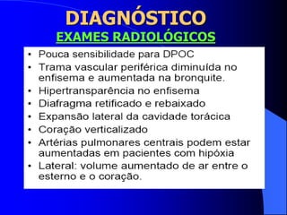 DIAGNÓSTICO
EXAMES RADIOLÓGICOS
 