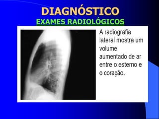 DIAGNÓSTICO
EXAMES RADIOLÓGICOS
 