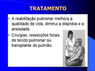 TRATAMENTO
 
