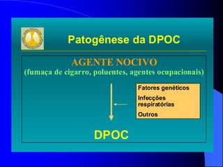 Patogênese da DPOC
AGENTE NOCIVO
(fumaça de cigarro, poluentes, agentes ocupacionais)
DPOC
Fatores genéticos
Infecções
respiratórias
Outros
 
