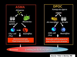 Mastócitos
CD4+ cell
(Th2)
Eosinófilos
Alérgenos
Células
epitélio
ASMA
Broncoconstrição
Hiperresponsividade
Alv macrófago Ep cells
CD8+ cell
(Tc1)
Neutrófilos
Fumaça de cigarro
Redução calibre pequenas
vias e Destruição alveolar
DPOC
Reversível IrreversívelLimitação do fluxo aéreo
Source: Peter J. Barnes, MD
 