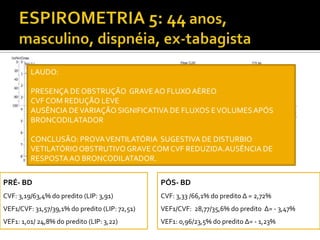 PRÉ- BD
CVF: 3,19/63,4% do predito (LIP: 3,91)
VEF1/CVF: 31,57/39,1% do predito (LIP: 72,51)
VEF1: 1,01/ 24,8% do predito (LIP: 3,22)
PÓS- BD
CVF: 3,33 /66,1% do predito Δ = 2,72%
VEF1/CVF: 28,77/35,6% do predito Δ= - 3,47%
VEF1: 0,96/23,5% do predito Δ= - 1,23%
LAUDO:
PRESENÇA DE OBSTRUÇÃO GRAVEAO FLUXO AÉREO
CVF COM REDUÇÃO LEVE
AUSÊNCIA DEVARIAÇÃO SIGNIFICATIVA DE FLUXOS EVOLUMESAPÓS
BRONCODILATADOR
CONCLUSÃO: PROVAVENTILATÓRIA SUGESTIVA DE DISTURBIO
VETILATÓRIOOBSTRUTIVOGRAVE COM CVF REDUZIDA.AUSÊNCIA DE
RESPOSTAAO BRONCODILATADOR.
 
