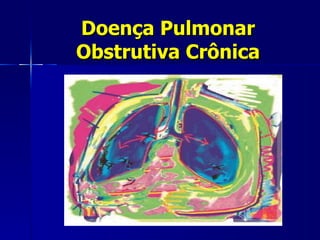 Doença Pulmonar Obstrutiva Crônica 