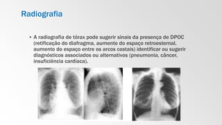 Radiografia
▪ A radiografia de tórax pode sugerir sinais da presença de DPOC
(retificação do diafragma, aumento do espaço retroesternal,
aumento do espaço entre os arcos costais) identificar ou sugerir
diagnósticos associados ou alternativos (pneumonia, câncer,
insuficiência cardíaca).
 