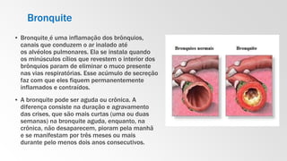 Bronquite
▪ Bronquite é uma inflamação dos brônquios,
canais que conduzem o ar inalado até
os alvéolos pulmonares. Ela se instala quando
os minúsculos cílios que revestem o interior dos
brônquios param de eliminar o muco presente
nas vias respiratórias. Esse acúmulo de secreção
faz com que eles fiquem permanentemente
inflamados e contraídos.
▪ A bronquite pode ser aguda ou crônica. A
diferença consiste na duração e agravamento
das crises, que são mais curtas (uma ou duas
semanas) na bronquite aguda, enquanto, na
crônica, não desaparecem, pioram pela manhã
e se manifestam por três meses ou mais
durante pelo menos dois anos consecutivos.
 