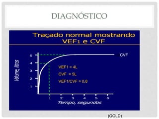 DIAGNÓSTICO
VEF1 = 4L
CVF = 5L
VEF1/CVF = 0,8
ccCVF
(GOLD)
 