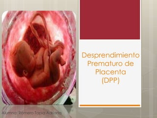 Desprendimiento
Prematuro de
Placenta
(DPP)

Alumna: Romero Tapia Adriana

 