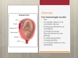 Formas:
Con hemorragia oculta:
•

20%

•

La sangre drena a la
cavidad uterina
El desprendimiento es
completo
Complicaciones
frecuentemente son
graves
5 a 8% desarrollan
coagulopatias
La muerte fetal es mas
probable

•
•

•
•

 
