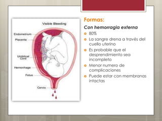 Formas:
Con hemorragia externa







80%
La sangre drena a través del
cuello uterino
Es probable que el
desprendimiento sea
incompleto
Menor numero de
complicaciones
Puede estar con membranas
intactas

 
