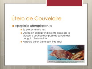 Útero de Couvelaire
 Apoplejía uteroplacenta
 Se presenta rara vez
 Ocurre en el desprendimiento grave de la
placenta cuando hay paso de sangre del
cuagulo al miometrio
 Aspecto de un útero con tinte azul

 