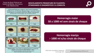 portaldeboaspraticas.iff.fiocruz.br
DESCOLAMENTO PREMATURO DE PLACENTA:
OTIMIZANDO O DIAGNÓSTICO E A CONDUTA
RCOG Green top guideline: Antepartum
hemorrhage. 2011
Hemorragia maciça
> 1000 ml e/ou sinais de choque
Hemorragia maior
50 a 1000 ml sem sinais de choque
 