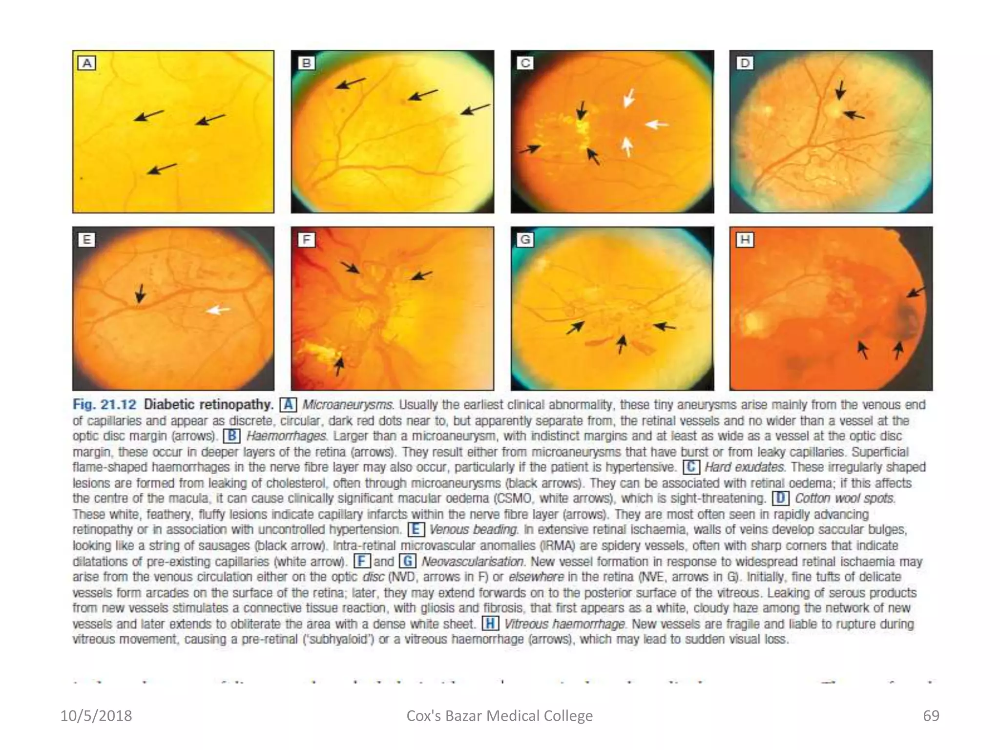 10/5/2018 69Cox's Bazar Medical College
 