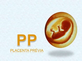 PLACENTA PRÉVIA
 