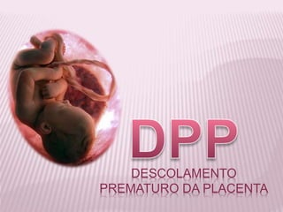 DESCOLAMENTO
PREMATURO DA PLACENTA
 