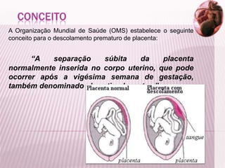 CONCEITO
A Organização Mundial de Saúde (OMS) estabelece o seguinte
conceito para o descolamento prematuro de placenta:
“A separação súbita da placenta
normalmente inserida no corpo uterino, que pode
ocorrer após a vigésima semana de gestação,
também denominado abruptio placentae.”
 