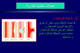 2-  السكتة الدماغية   : تحدث السكتة بسبب تخثر أو تمزق بالأوعية الدموية الدماغية ,  و تختلف أعراض السكتة الدماغية و حدتها حسب المنطقة المتأثرة بالمخ و مساحتها  . الحالات الطبية الطارئة 