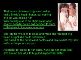 Their nurse did everything she could to 
make Brielle’s health better, but nothing 
she did was helping her. 
With nothing else to do, their nurse went 
against hospital policy and decided to place
both babies in the same incubator.
She left the twin girls to sleep and when she returned she 
found a sight she could not believe. 
She called all the nurses and doctors and this is what they saw 
(refer to the picture above). 
As Brielle got closer to her sister, Kyrie put her small little
arm around her, as if to hug and support her sister.
 
