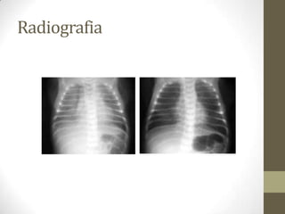 Radiografia
 