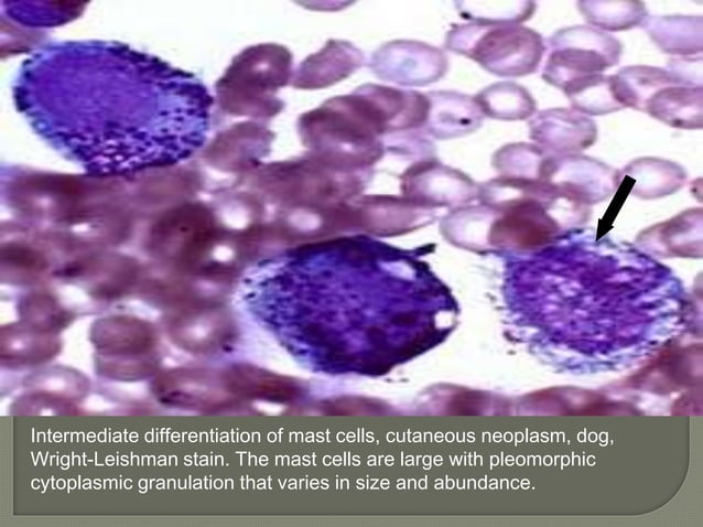 dr-vishal-mastocytoma-ppsx