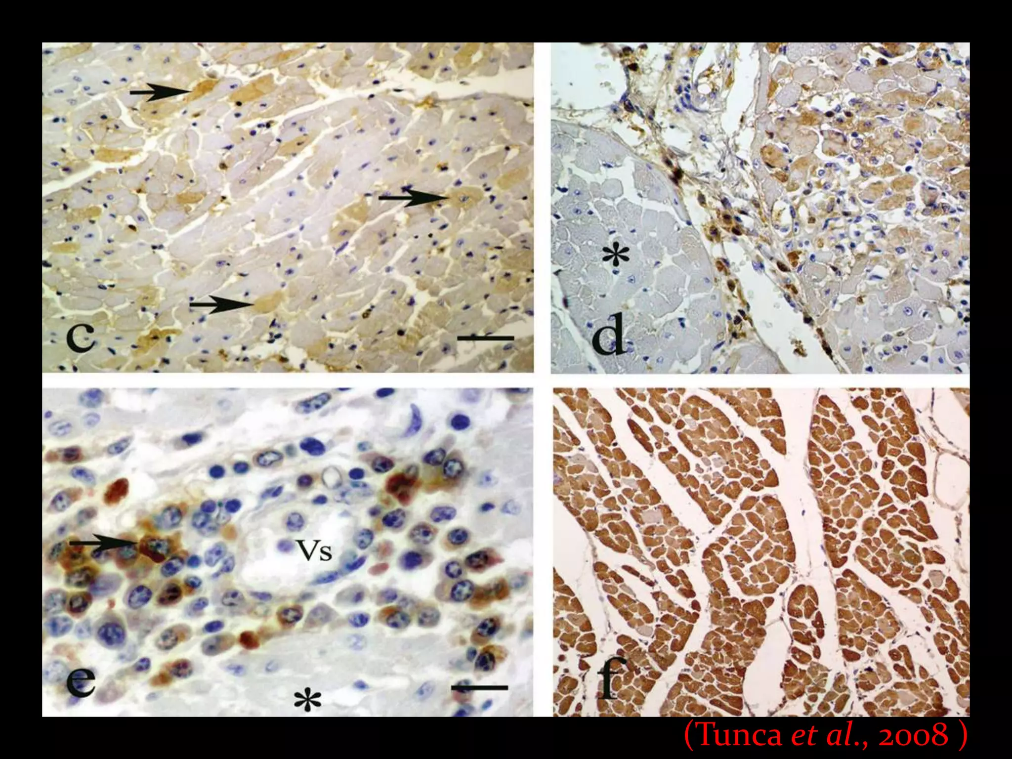 (Tunca et al., 2008 )
 