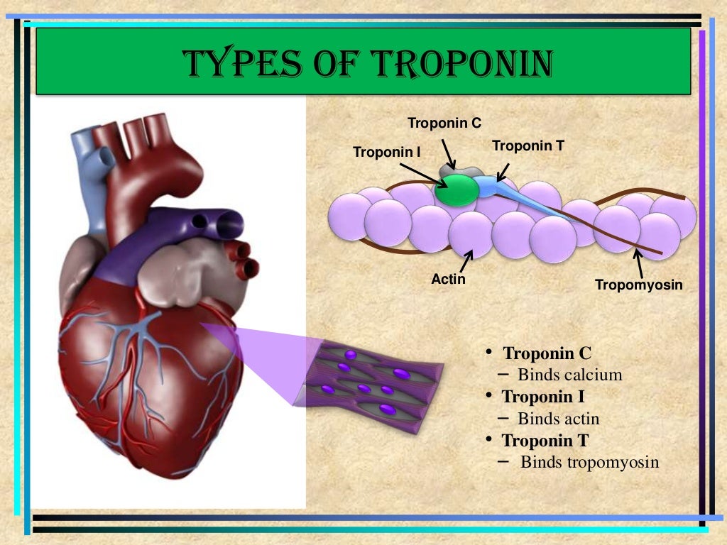 Cardiac troponin (Dr.Vishal)