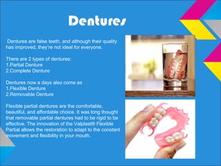 Dentures
Dentures are false teeth, and although their quality
has improved, they’re not ideal for everyone.
There are 2 types of dentures:
1.Partial Denture
2.Complete Denture
Dentures now a days also come as
1.Flexible Denture
2.Removable Denture
Flexible partial dentures are the comfortable,
beautiful, and affordable choice. It was long thought
that removable partial dentures had to be rigid to be
effective. The innovation of the Valplast® Flexible
Partial allows the restoration to adapt to the constant
movement and flexibility in your mouth.
 