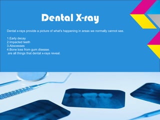 Dental X-ray
Dental x-rays provide a picture of what's happening in areas we normally cannot see.
1.Early decay
2.Impacted teeth
3.Abscesses
4.Bone loss from gum disease.
are all things that dental x-rays reveal.
 