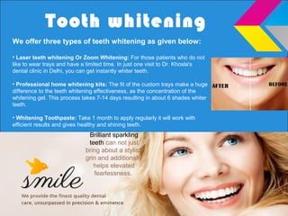 Tooth whitening
Brilliant sparkling
teeth can not just
bring about a stylish
grin and additionally
helps elevated
fearlessness.
We offer three types of teeth whitening as given below:
• Laser teeth whitening Or Zoom Whitening: For those patients who do not
like to wear trays and have a limited time. In just one visit to Dr. Khosla's
dental clinic in Delhi, you can get instantly whiter teeth.
• Professional home whitening kits: The fit of the custom trays make a huge
difference to the teeth whitening effectiveness, as the concentration of the
whitening gel. This process takes 7-14 days resulting in about 6 shades whiter
teeth.
• Whitening Toothpaste: Take 1 month to apply regularly it will work with
efficient results and gives healthy and shining teeth.
 