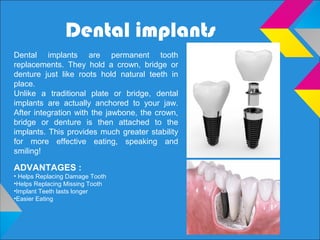 Dental implants
Dental implants are permanent tooth
replacements. They hold a crown, bridge or
denture just like roots hold natural teeth in
place.
Unlike a traditional plate or bridge, dental
implants are actually anchored to your jaw.
After integration with the jawbone, the crown,
bridge or denture is then attached to the
implants. This provides much greater stability
for more effective eating, speaking and
smiling!
ADVANTAGES :
• Helps Replacing Damage Tooth
•Helps Replacing Missing Tooth
•Implant Teeth lasts longer
•Easier Eating
 