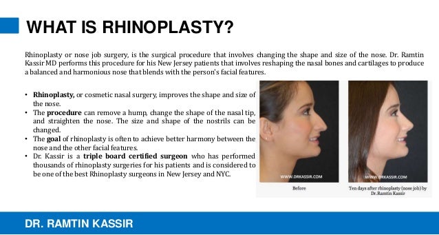 what is rhinoplasty