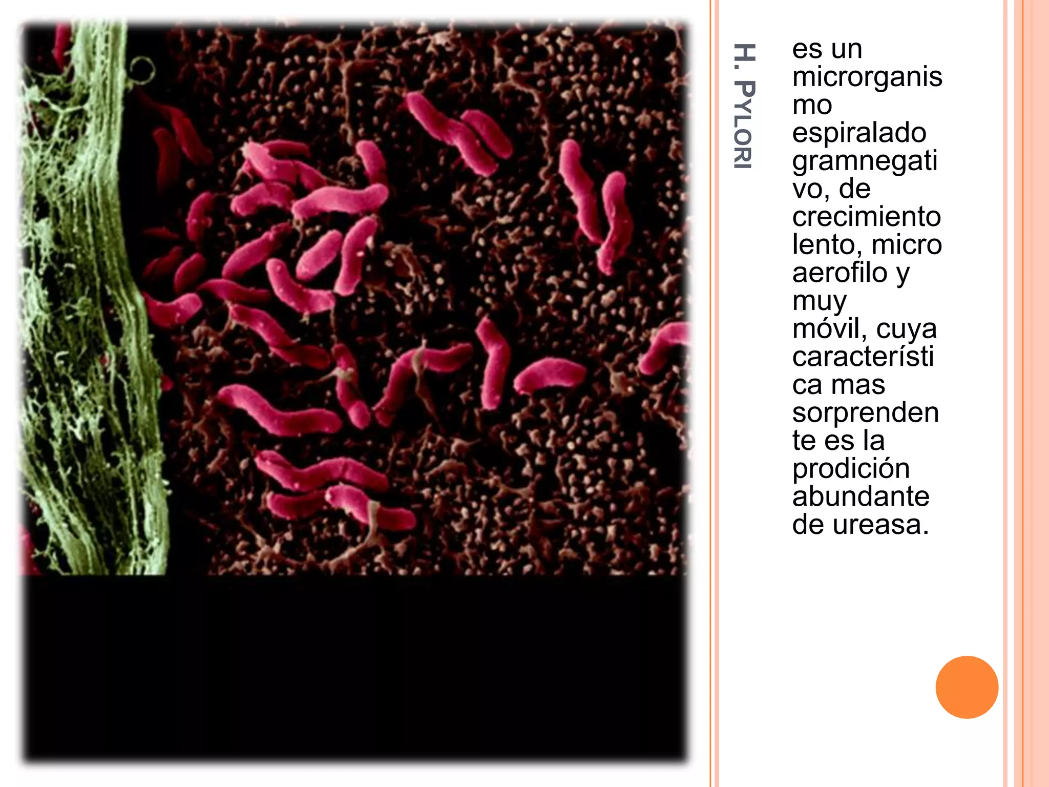 H.PYLORI
es un
microrganis
mo
espiralado
gramnegati
vo, de
crecimiento
lento, micro
aerofilo y
muy
móvil, cuya
característi
ca mas
sorprenden
te es la
prodición
abundante
de ureasa.
 