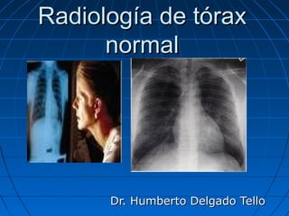 Radiología de tórax
normal

Dr. Humberto Delgado Tello

 