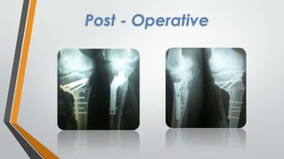 Post - Operative

 