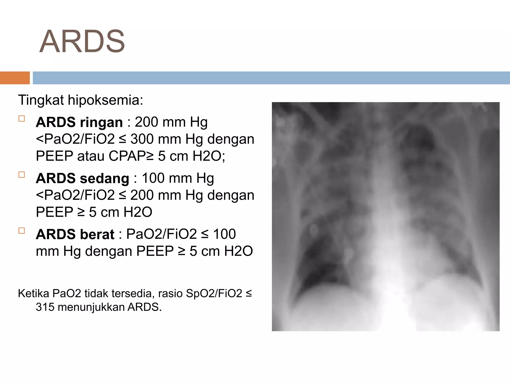 Pao2 Sao2 Ards Tatalaksana klinis Middle East Respiratory Syndrome Corona Virus | PPSX