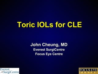 Toric IOLs for CLE
John Cheung, MD
Everest SurgiCentre
Focus Eye Centre

 