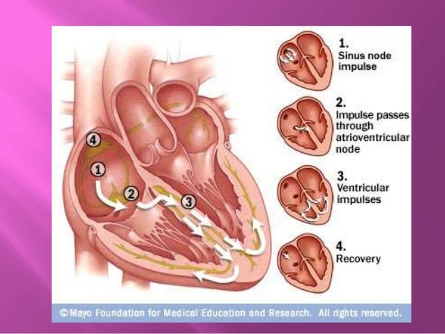 icd 10 for sick sinus syndrome icd 10 for sick sinus syndrome